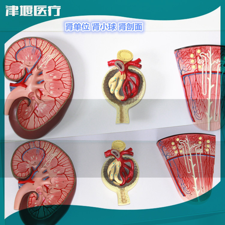 人体解剖模型 肾解剖模型 自然大肾解剖附肾上腺模型 肾上腺模型-阿里巴巴