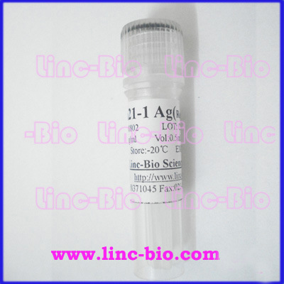 CK-MBԭ/CK-MB Agἤøͬø(CK-MB) Antigenִ