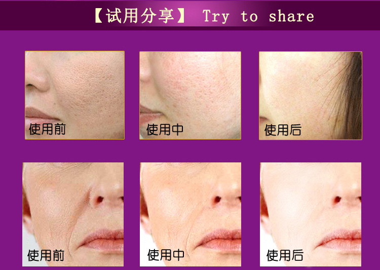 瘦臉機詳情頁_12