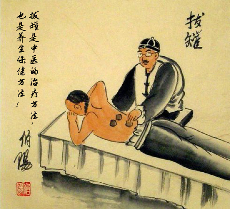 美女拔罐圖1_副本