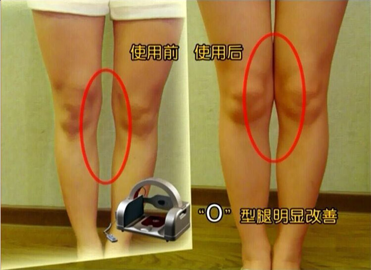 产后盆底修复仪 产后塑型美容仪 骨盆修复仪