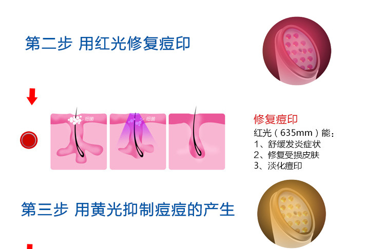 新款祛痘機詳情_06