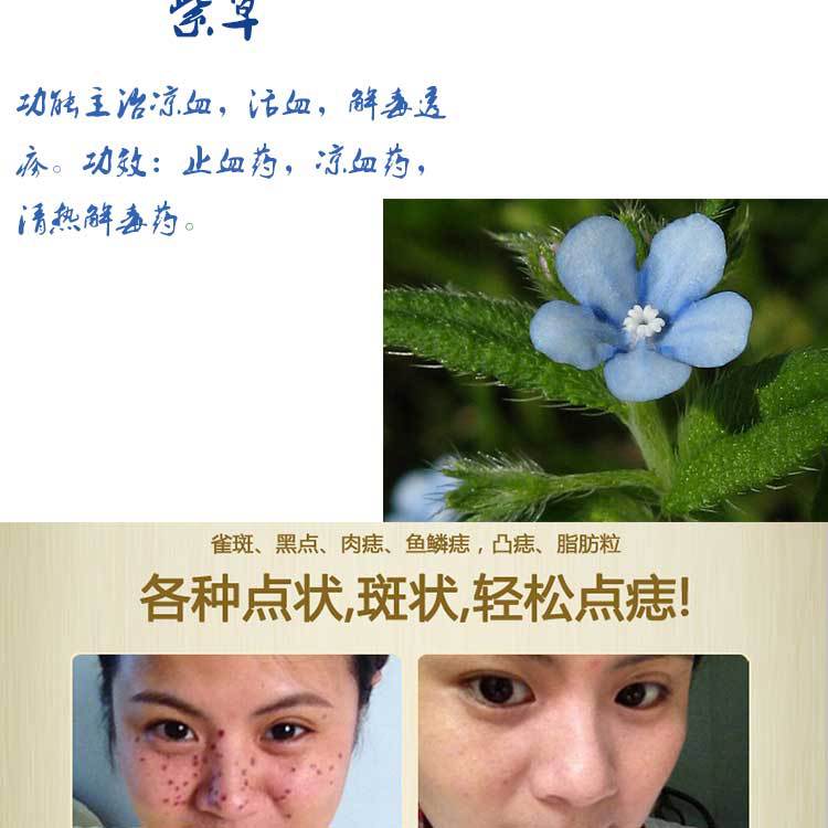 點斑水 七天不留痕無痛點斑點痣水 點斑祛斑水可點雀斑 疣 點斑液