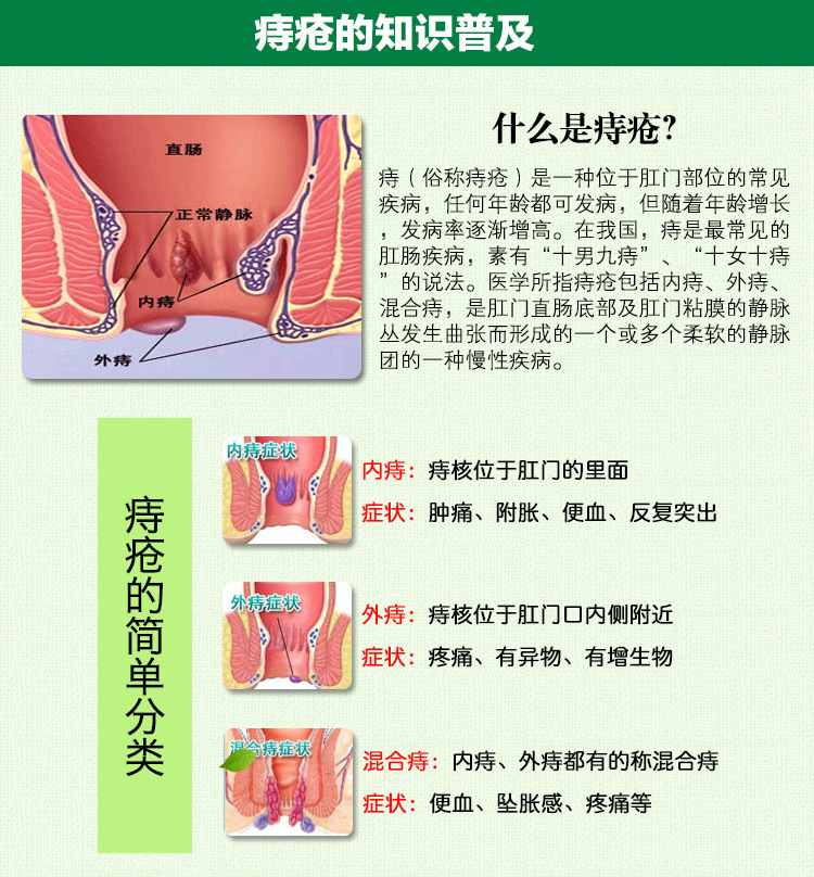 痔疮图解大全,痔疮图片大全 - 伤感说说吧