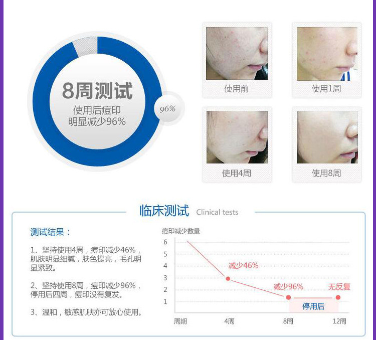 祛痘修復_14
