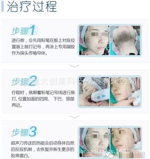 超聲刀治療流程_北京遠大創美醫療美容機器