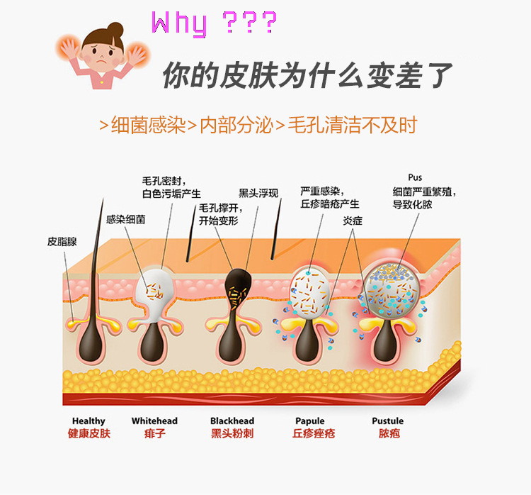 und廠傢貨源OEM傢用麵部黑頭清潔器電動清潔美容機器爆款吸黑頭神器efined