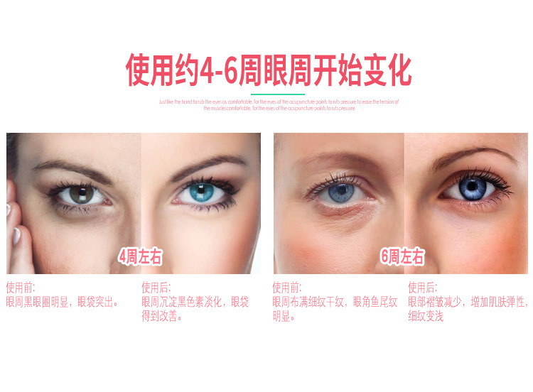 傢用眼部按摩美眼機感應美眼機消除眼部浮腫黑眼圈眼部按摩神器undefined