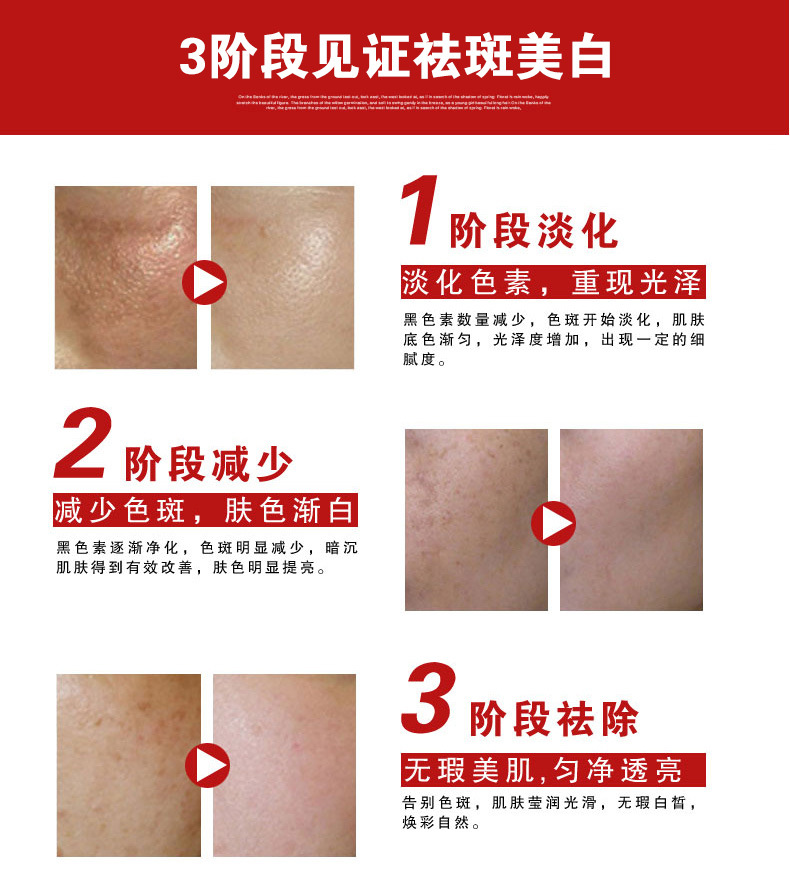 祛斑美白霜_09