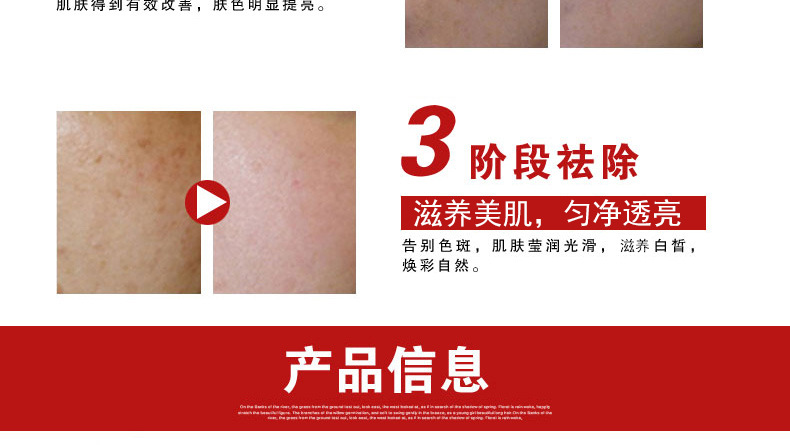 妙正祛斑美白霜_13