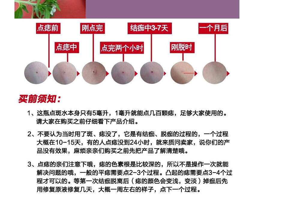 美容金水無痛點斑水點痣水點斑藥水祛痣祛疚點疚加工生產(chǎn)批發(fā)OEM