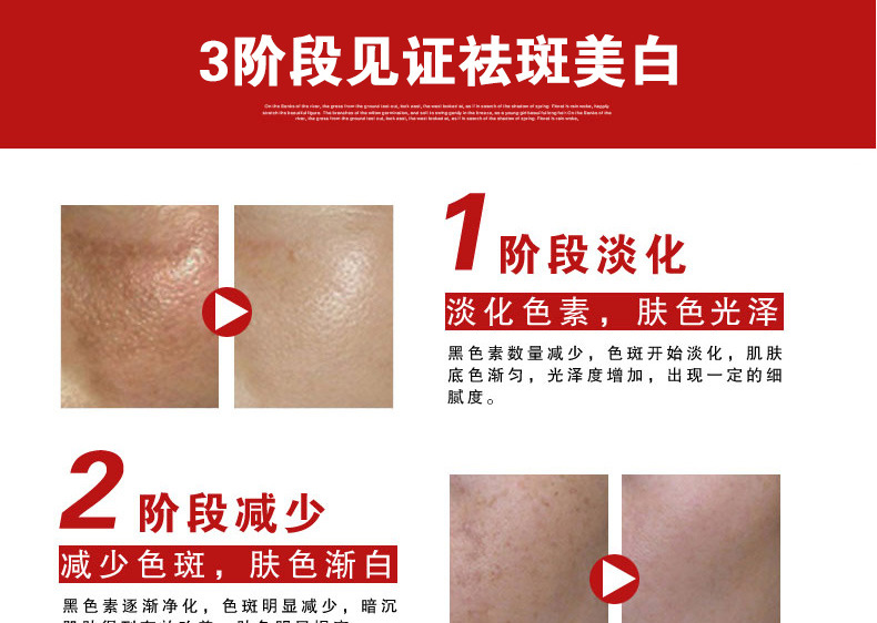 妙正祛斑美白霜_12