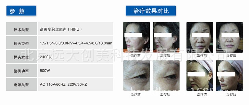 超聲刀使用效果對比