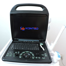 醫用設備高清3D4D彩超機檢查胎兒頸動脈便捷手提式彩超