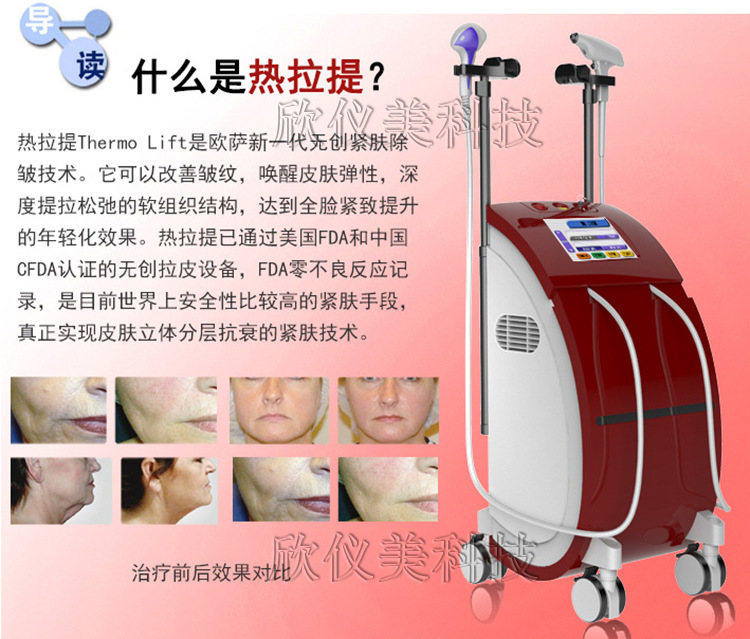 面部美容仪器_紧致提升深蓝射频40.68抗衰美