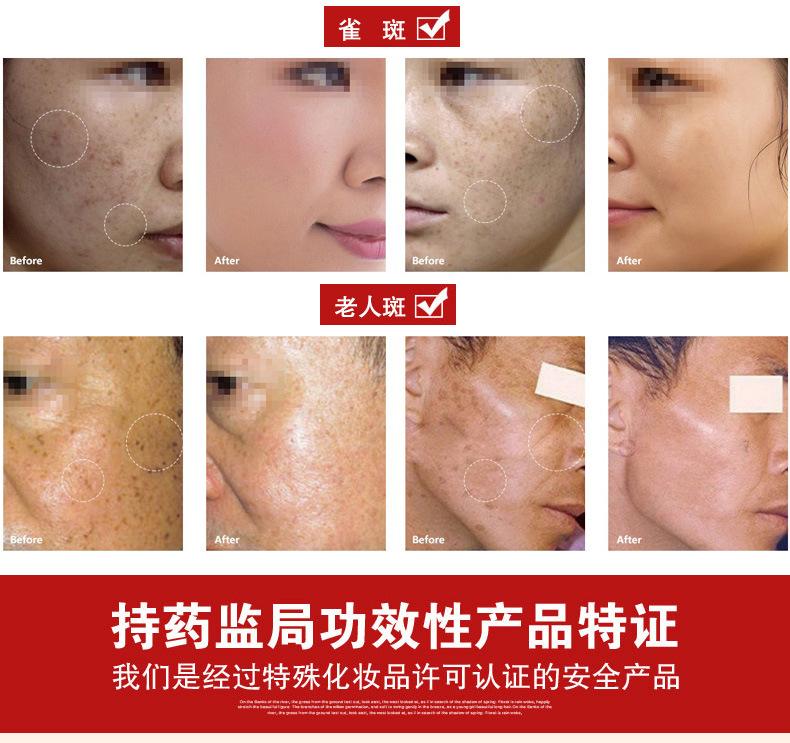 祛斑美白霜_03