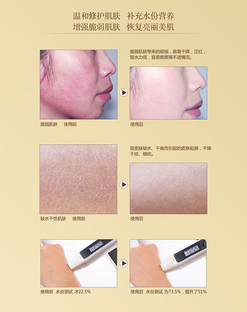 廠家洋甘菊純露 補(bǔ)水保濕收縮毛孔控油純露 化妝品oem加工定制款