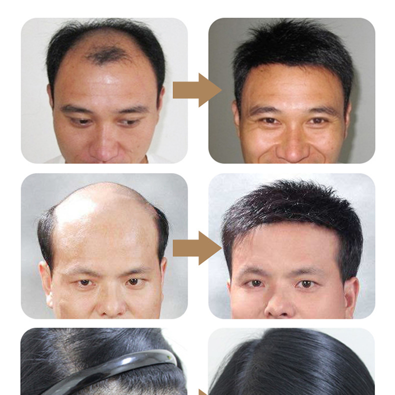 i2 XifKkz9SEOZoouDvmzTXsGerjyOVuG08j