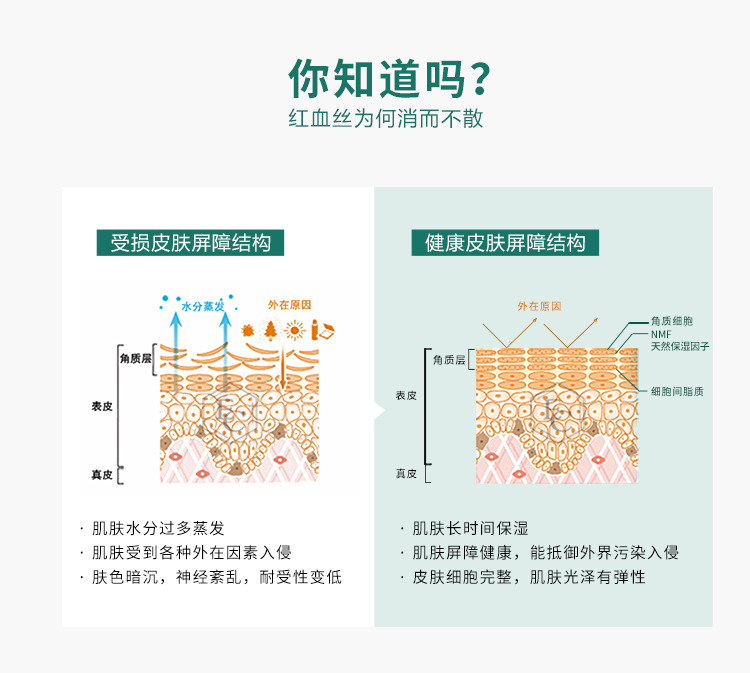 H1红血丝修复_03