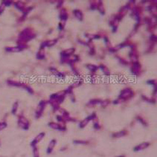 �����@΢��Ƭ�˱����b �b���W��Ƭ�����N�� ��У��������Ƭ