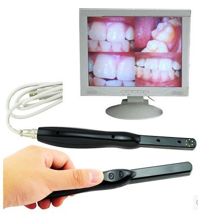 Стоматологический стоматологический эндоскоп высокой четкости с программным обеспечением для помощи рук и рта, внутренняя камера, камера 3.0million пиксель