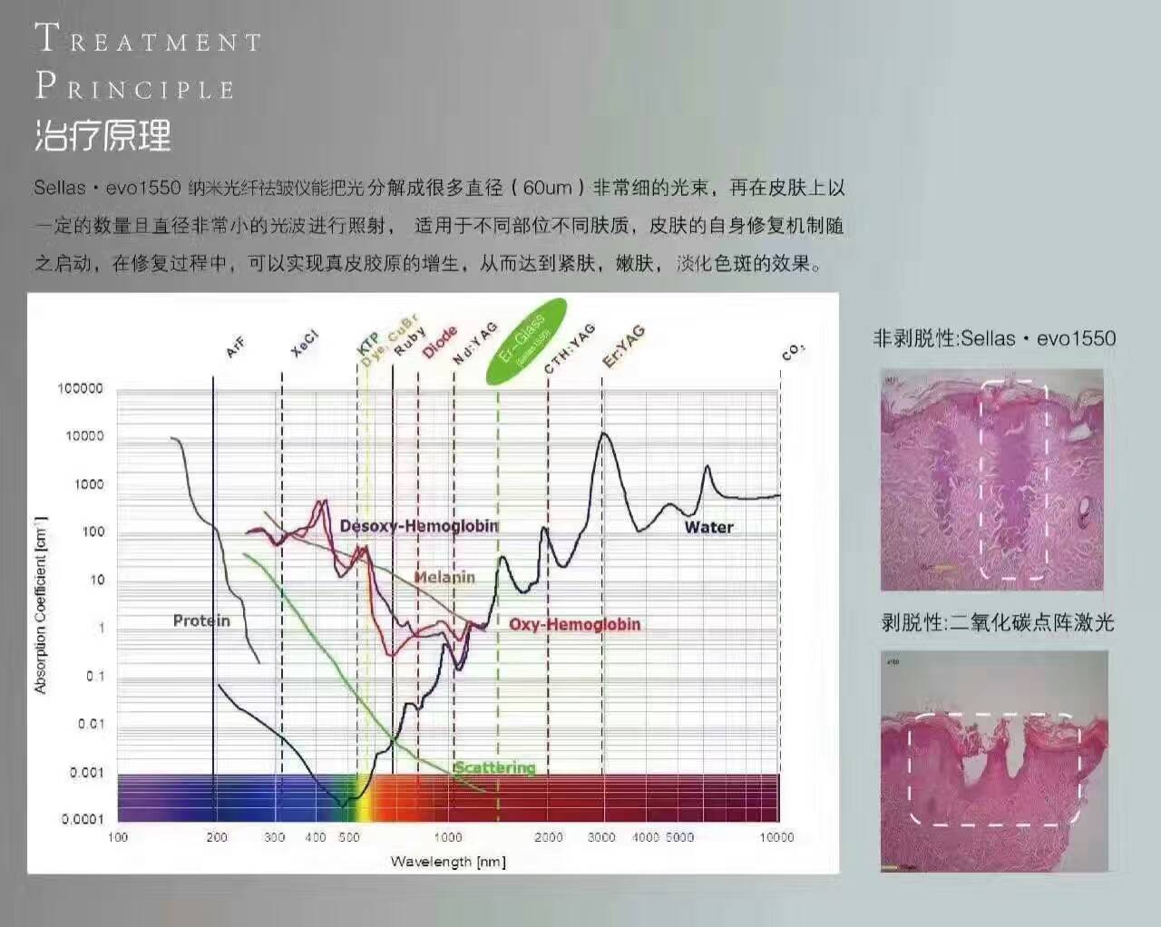 1550神光祛皱王 抗衰祛皱祛妊娠纹 光纤皮秒1550
