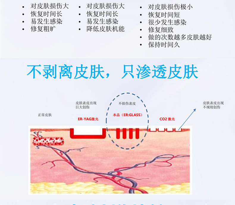 1550神光祛皱王 抗衰祛皱祛妊娠纹 光纤皮秒1550
