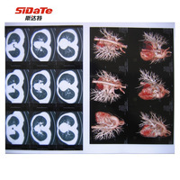 厂家直销斯达特JG5-6-1白色半透明磨砂防水耐撕医用胶片