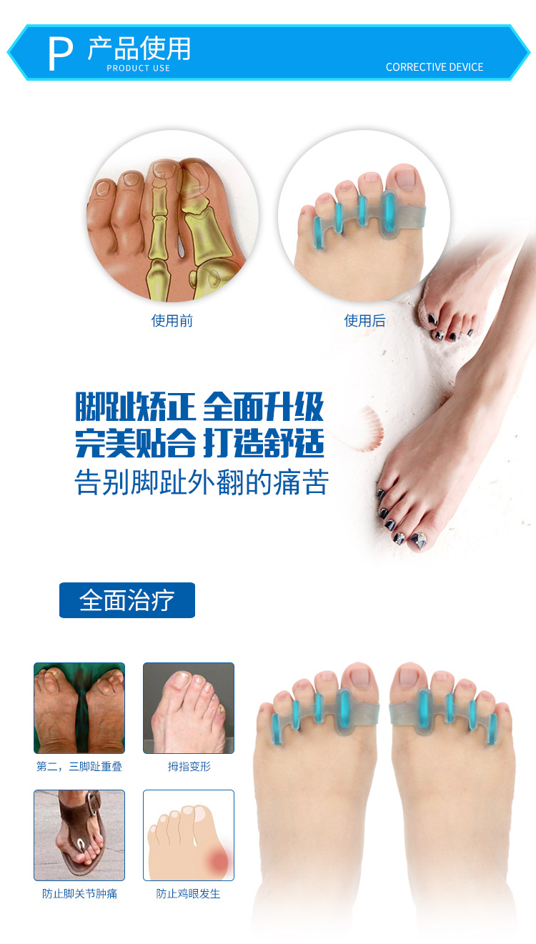 拇指矫正器--天蓝_03