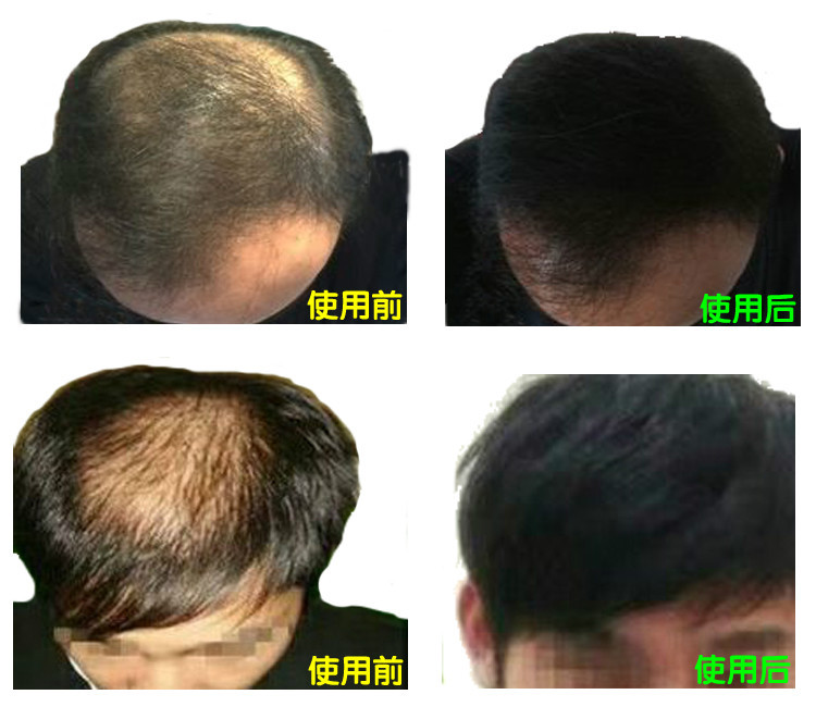 TB26kPaqYplpuFjSspiXXcdfFXa_!!