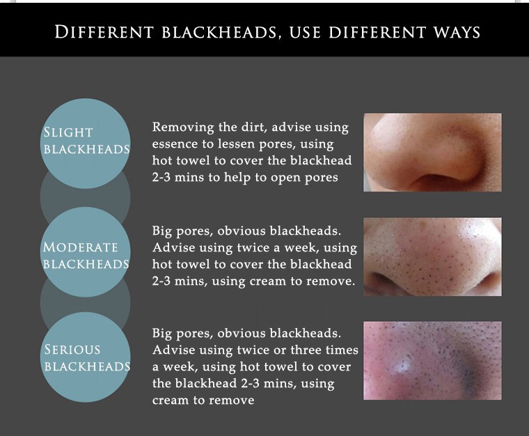 HTB1kiu1ljuhSKJjSspjq6Ai8VXaj