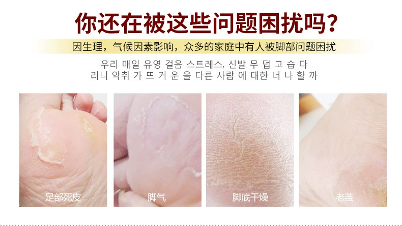 Han Wei chân đích thực kem chân dịu dàng massage tẩy tế bào chết kem chân để sửa chữa da chết chăm sóc bàn chân nam giới và phụ nữ