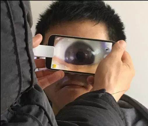 Применимо для мобильного телефона глаза зрачка макросъемки 25x светодиодная лампа