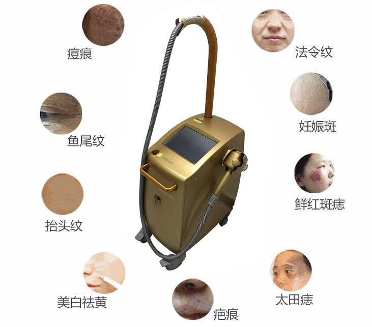 1550神光祛皱王 抗衰祛皱祛妊娠纹 光纤皮秒1550