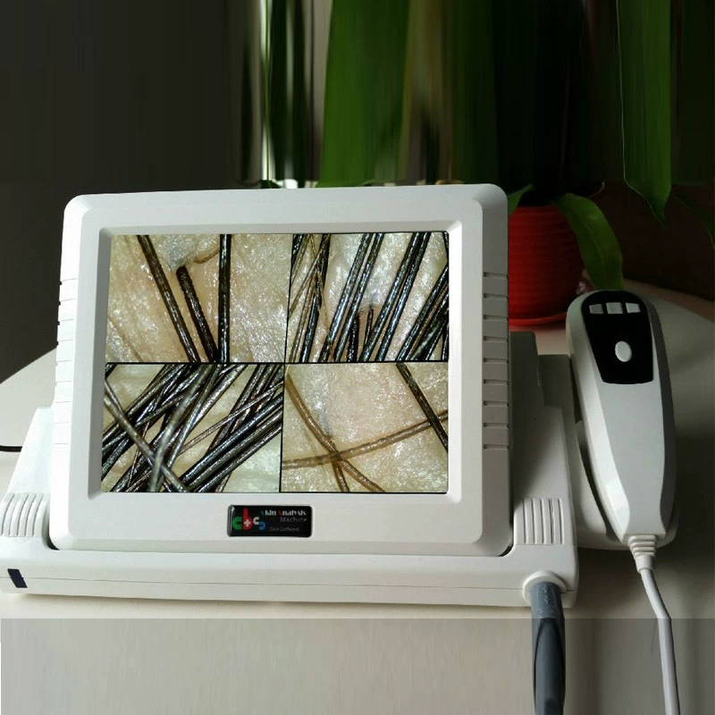 [Пожизненная гарантия] HD 8-дюймовый ЖК-экран для проверки волос на коже головы прибор для анализа волосяных фолликулов