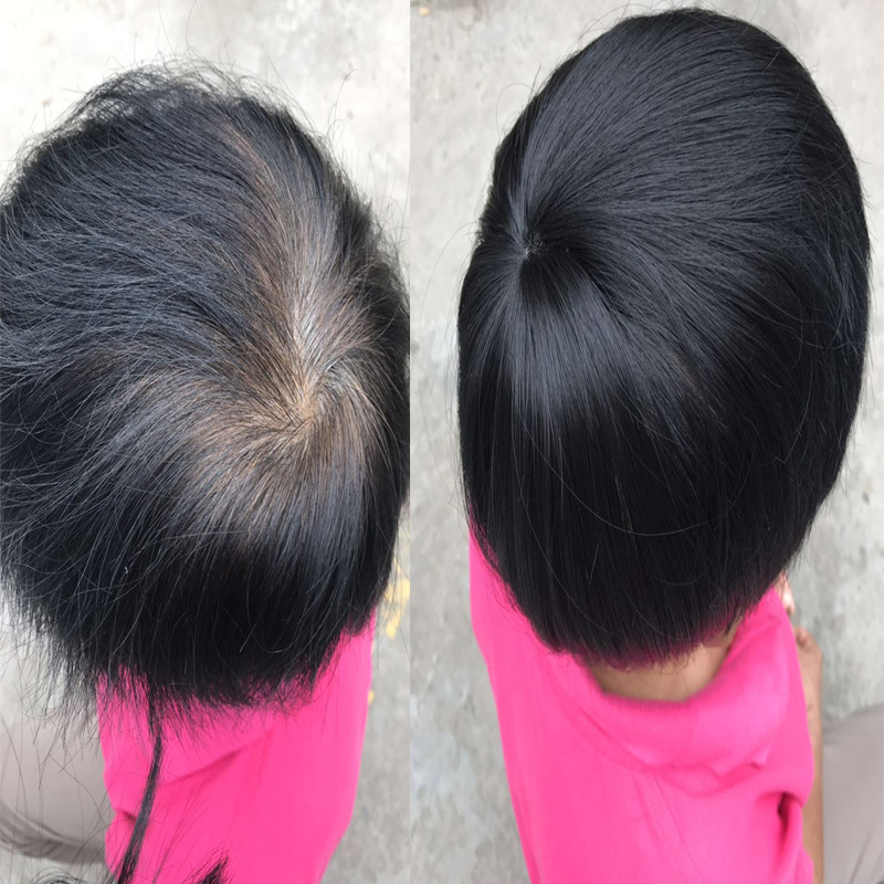 頭頂補發假發片仿真發男士女士發塊遮白發增加發量接發片自然逼真