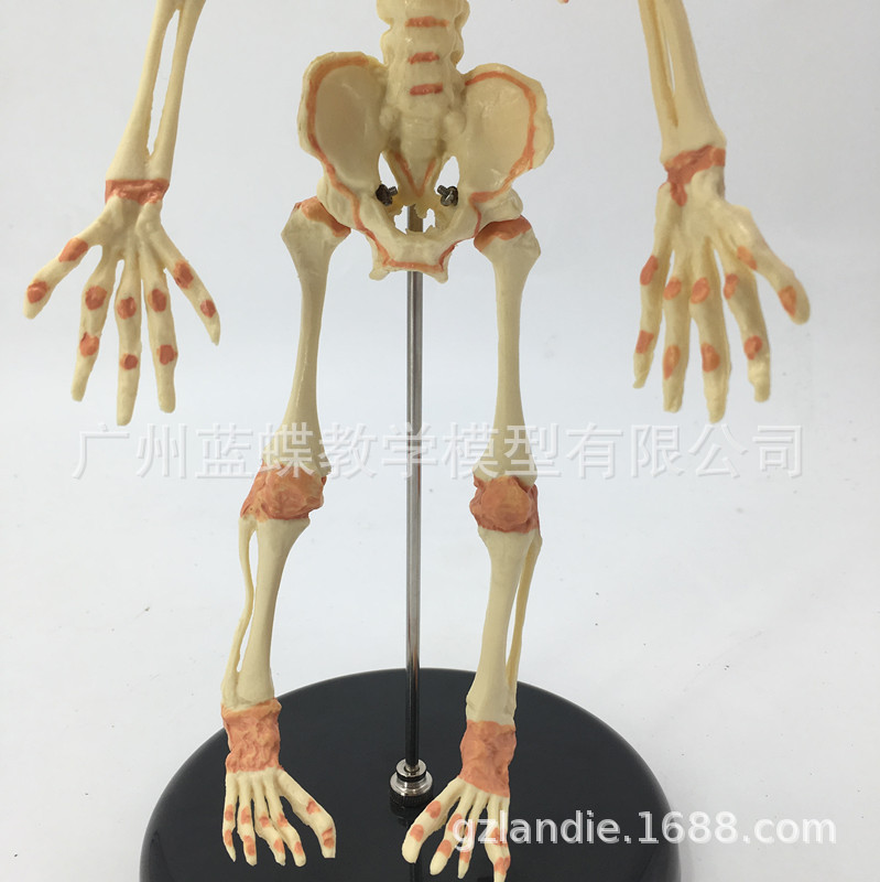 Ӥ������ģ�� Ӥ������ģ�� �׶��Ǽ� �˹�ģ�� �������� ��ѧ