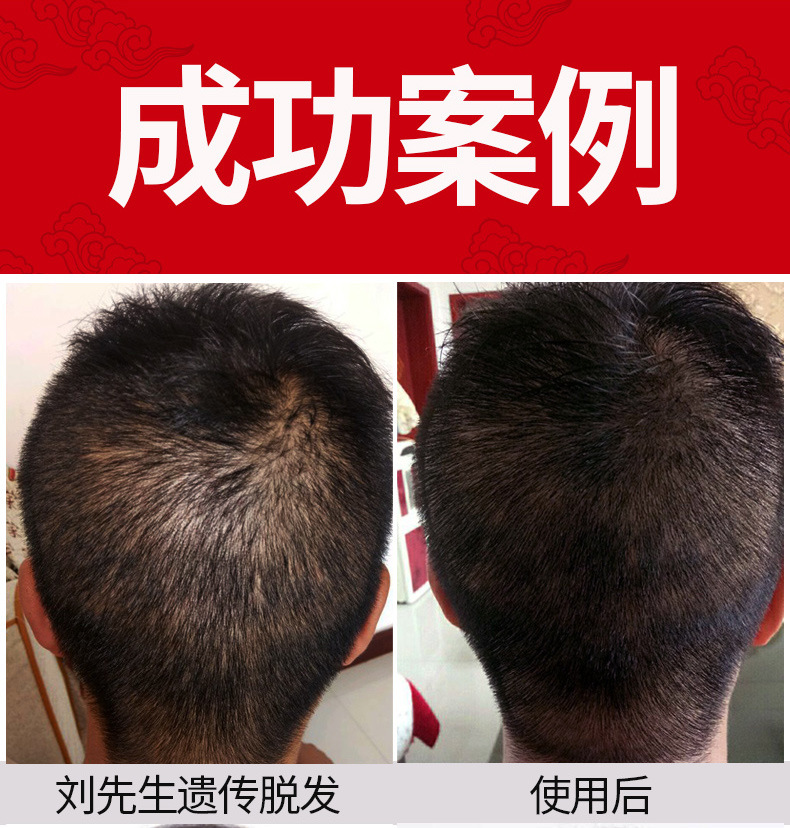 UP新版防脱发_02.jpg