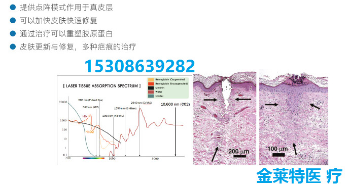 63393c3a-319a-4a96-bb54-8077e6