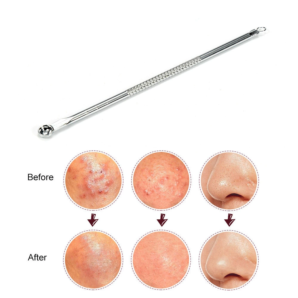 Double-sided cosmetic acne remover from black spots, 12.5cm, conceals acne