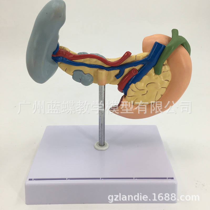 胰、脾、十二指肠病变模型 胰腺模型 脾脏模型胰腺病理 病态脾脏-阿里巴巴