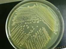 甘露醇高盐琼脂