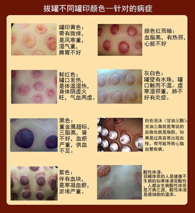 拔罐效果_副本