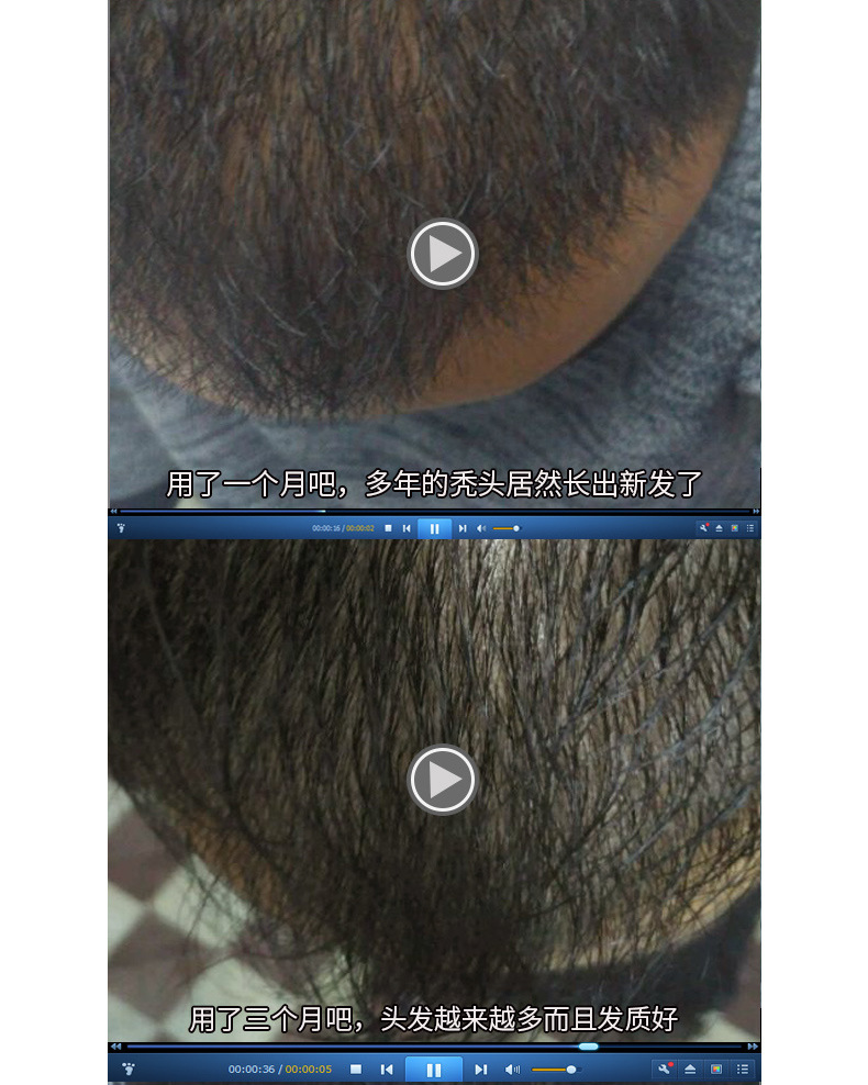 UP新版防脱发_07.jpg