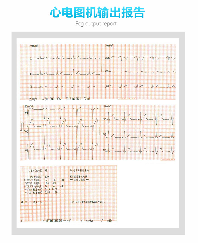 ECG-3303B-2 (7)