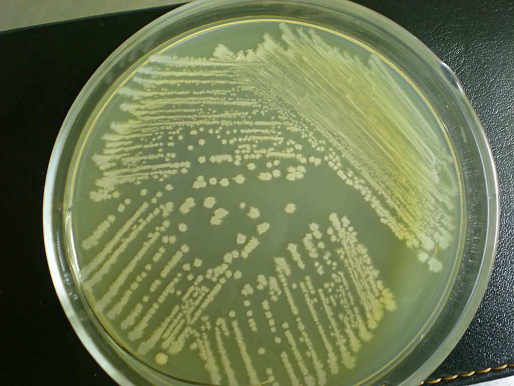 葡萄球菌选择性肉汤BAT