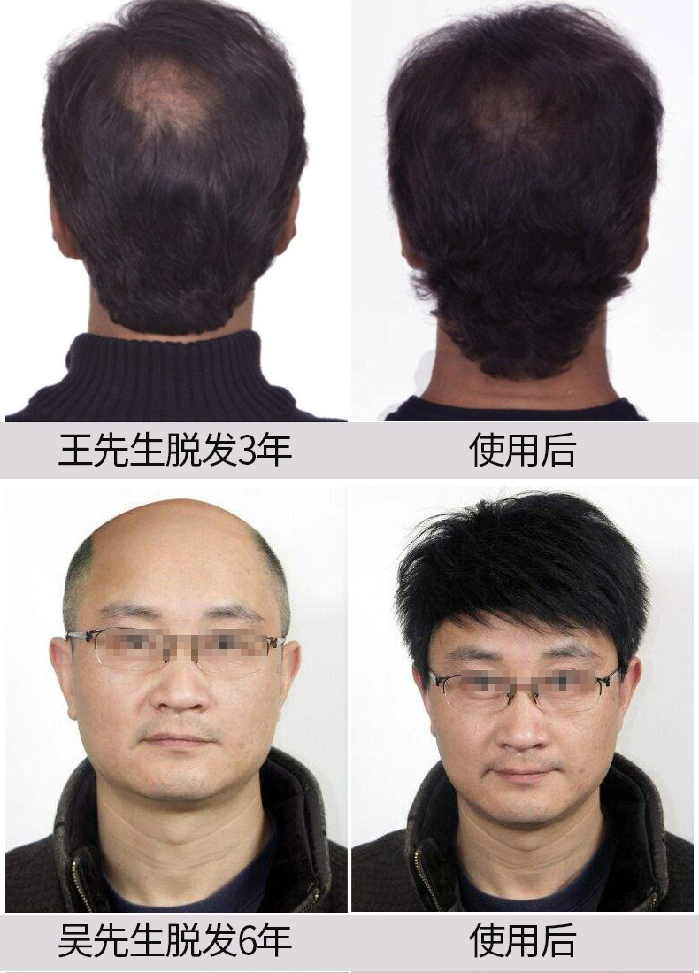 UP新版防脱发_03.jpg