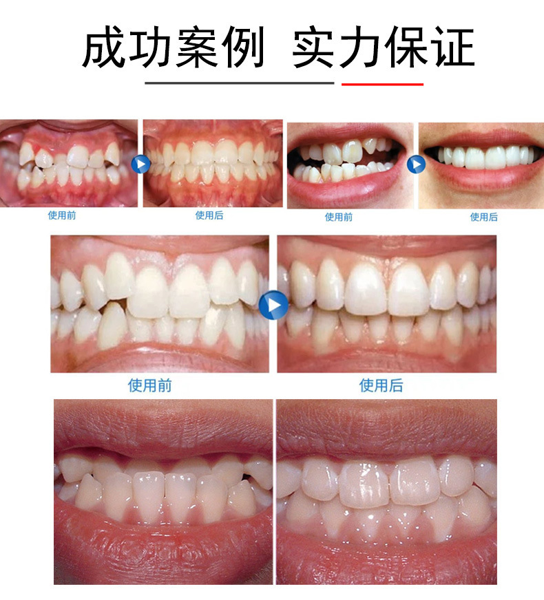矫正_12