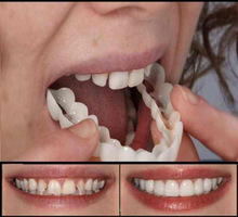 Niềng răng làm trắng mới Niềng răng mô phỏng bằng silicon chụp trên nụ cười Kem đánh răng làm trắng Bộ đồ làm trắng răng
