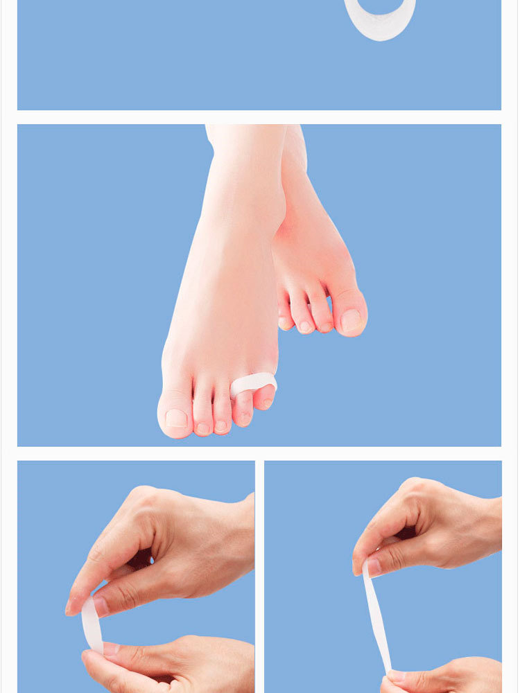 小脚趾内翻分趾器-小拇指外翻矫正器-保护套拇外翻重叠趾分离器